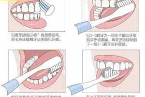 口腔护理新潮掌握最新刷牙技巧，健康口腔更轻松！